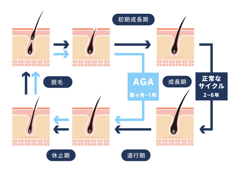 毛髪のサイクル
